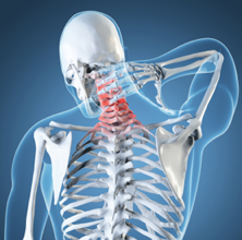 Workers Comp Doctor for Neck Pain