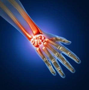 hand wrist carpal tunnel pain photo